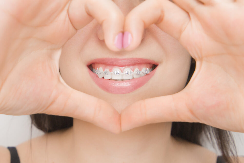 Orthodontic Dentistry in Corona, CA