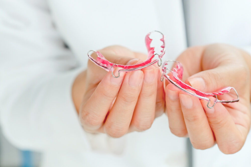 Retainers in Corona, CA